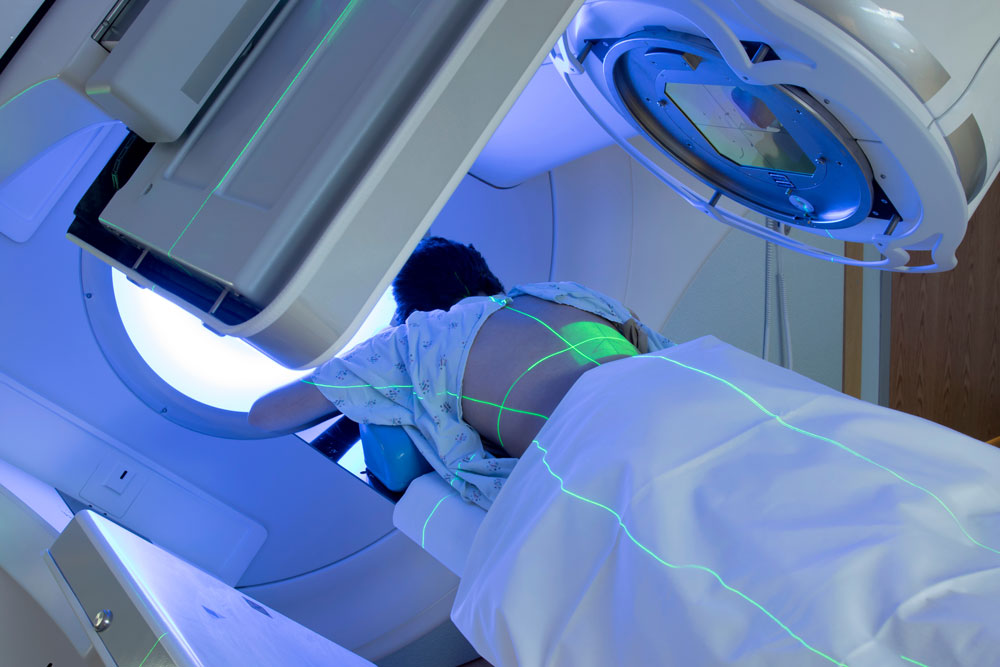 West_FL_External-Beam-Radiation-Therapy