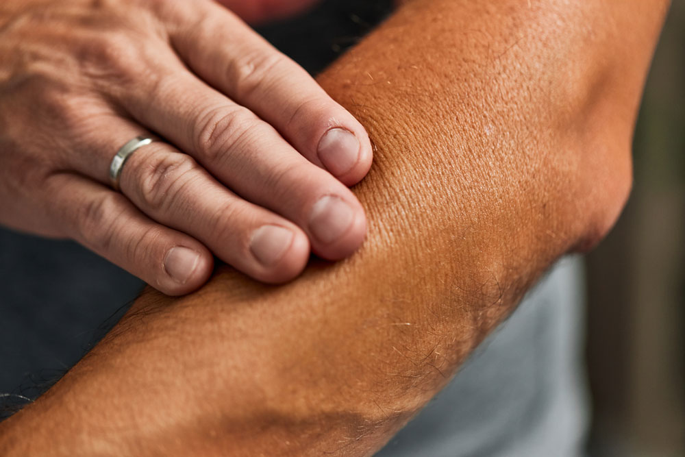 West_FL_Skin-Cancer_Side-Effects