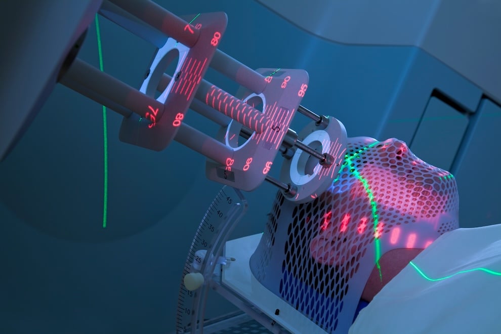 radiation for skin cancer treatment in clearwater florida